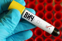 ВИЧ-инфекция: ученые обнаружили новый штамм  впервые за 20 лет