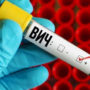 ВИЧ-инфекция: ученые обнаружили новый штамм  впервые за 20 лет