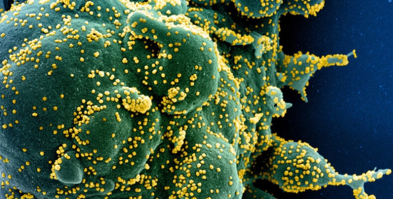 Ученые нашли у зараженных коронавирусом клеток «зловещие щупальца»