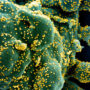 Ученые нашли у зараженных коронавирусом клеток «зловещие щупальца»